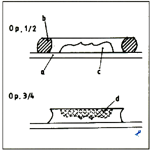 fib-03-14-b01.gif